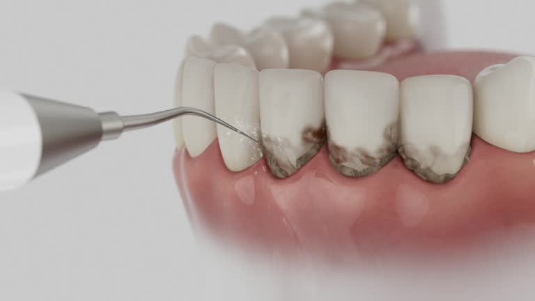 Trusted Dental Crowns And Bridges service in McDonald, OH - Dentist Open Now
